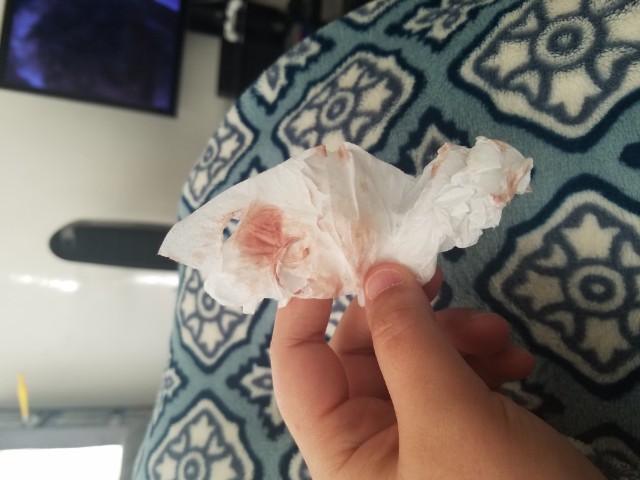 does this look like normal first trimester bleeding - Glow Community