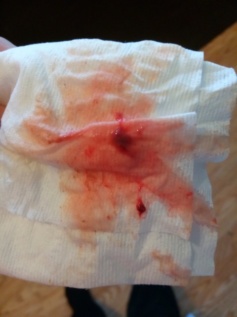 Mucus plug or bloody show or...? - Glow Community