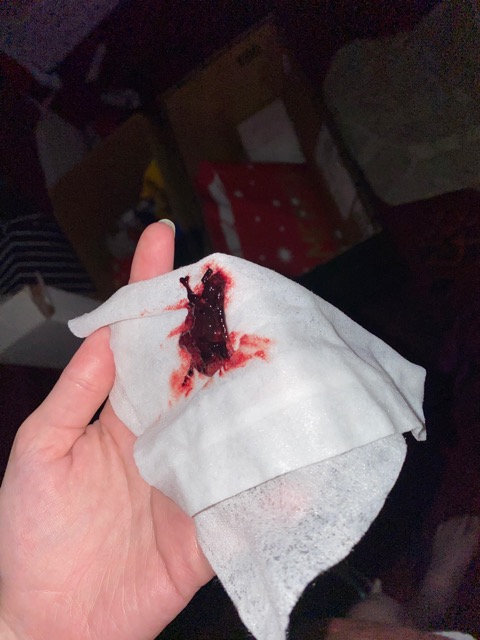 bleeding after using sex toy used a vibrator and started my period unknowingly, lifted the covers to  this🤦‍♀️ : r/MakeMeSuffer main image 1