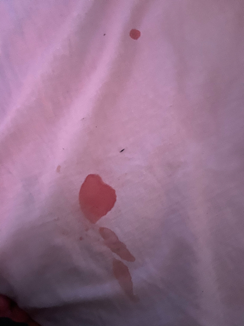 Bleeding after sex - Glow Community Bleeding after sex - Glow Community