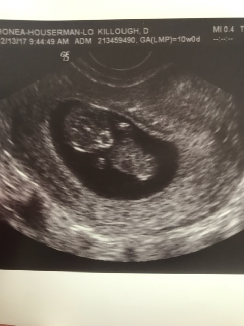 10 Week Ultrasound Scan
