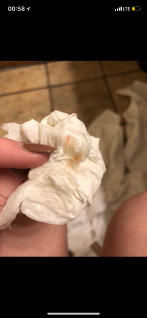 Bleeding after butt plug - Glow Community