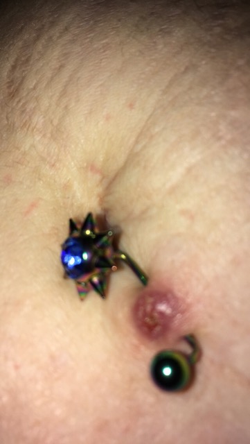 piercing bump why is pus coming out of my belly button piercing