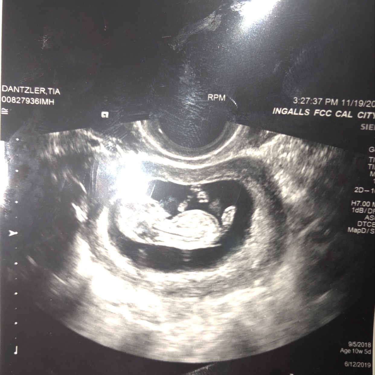 First ultrasound 10 weeks 5 days 🤤 - Glow Community, image size:1242x1242