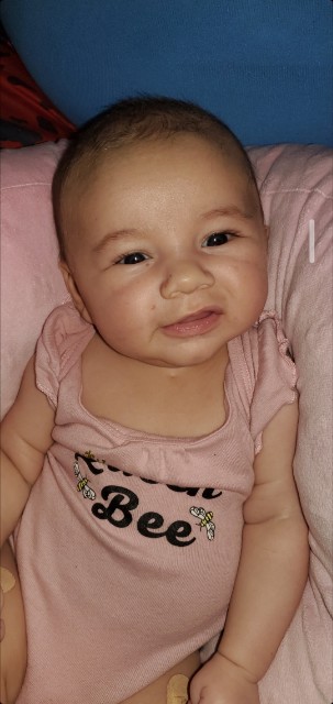 My daughter has this dimple on her chest..pediatrician didn't really ...